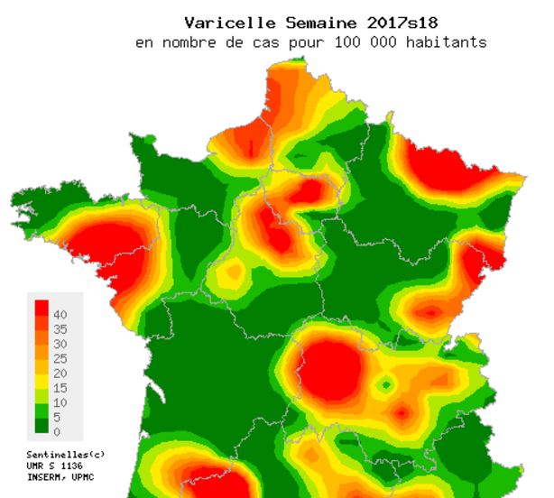 La varicelle est bien présente dans l’Oise