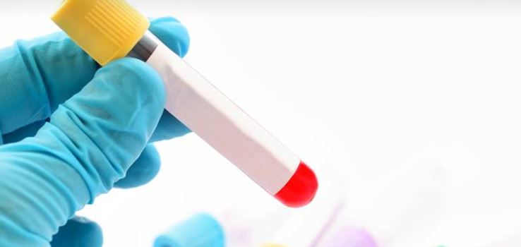 Sida à Creil : faites vous dépister !