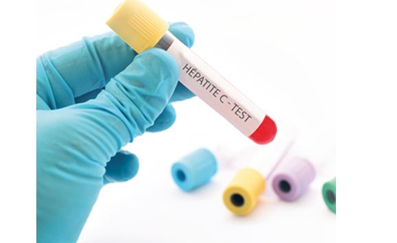 Dépistage gratuit à Creil : hépatites virales B, C et VIH