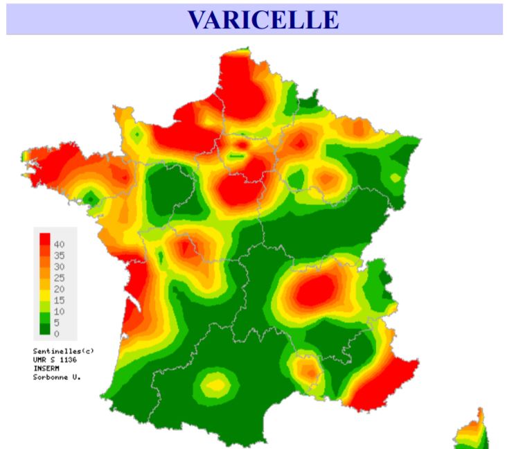 L’épidémie de varicelle s’installe dans notre région